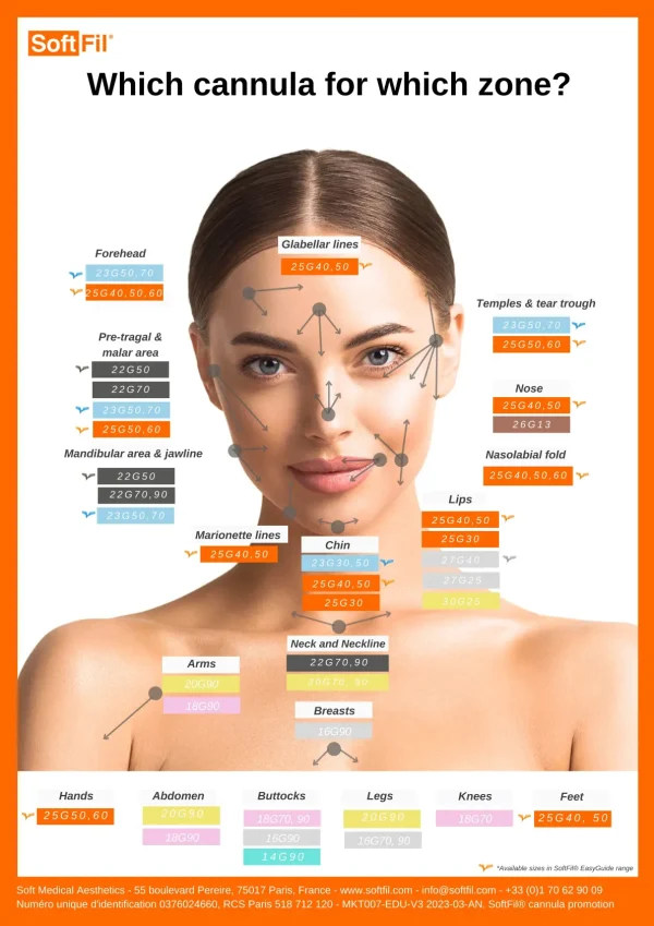 Microcanula SoftFil. Zone de aplicare.