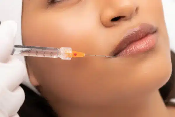 Microcanula SoftFil PRecision